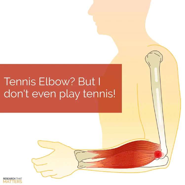 Chiropractic Ellicott City MD Tennis Elbow